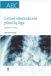 Lėtinė obstrukcinė plaučių liga - Humanitas