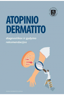 Atopinio dermatito diagnostikos ir gydymo rekomendacijos - Humanitas