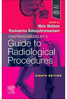 Chapman & Nakielny's Guide to Radiological Procedures - Humanitas