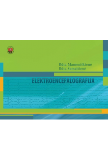 Elektroencefalografija - Humanitas