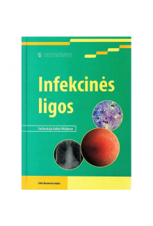 Infekcinės ligos - Humanitas