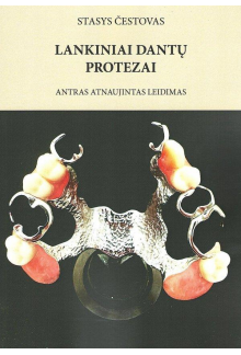 Lankiniai dantų protezai - Humanitas