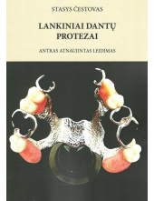 Lankiniai dantų protezai - Humanitas