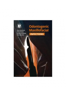 Odontogenic MaxillofacialInfections - Humanitas