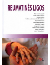 Reumatinės ligos - Humanitas