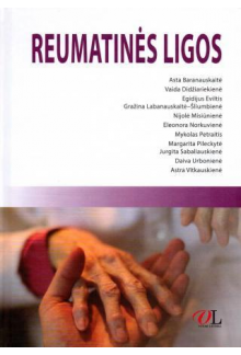 Reumatinės ligos - Humanitas